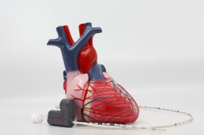 Le système pourrait simplifier le placement des électrodes de stimulation cardiaque.